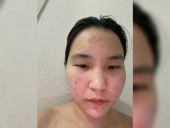 BabyYanSok — bongacams