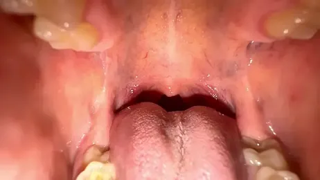 foxeslovefoxes — Stripchat recorded stream screenshot (18 Mar 2025)